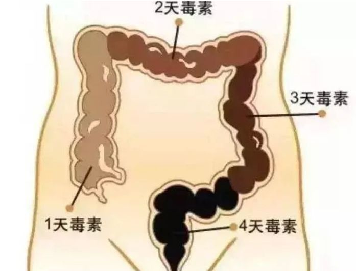 "大便"出现3种征兆,最好去检查一下,肠道可能"癌变"了