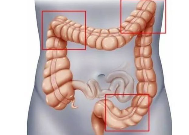 肚脐眼左下方,为乙状结肠部位,是粪便堆积的重要部位,也很容易导致