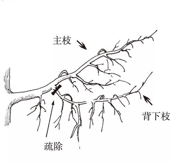 疏除背下枝