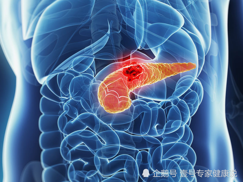 如果你的大便出现以上的情况,可能会是胰腺癌的第一个症状,即使是没