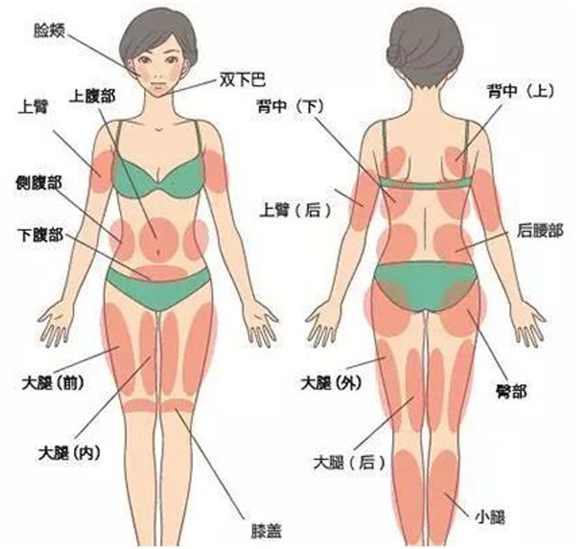 简言之,就是想瘦哪就瘦哪,具体部位包括:腹部,腰部,臀部,臂部,大腿