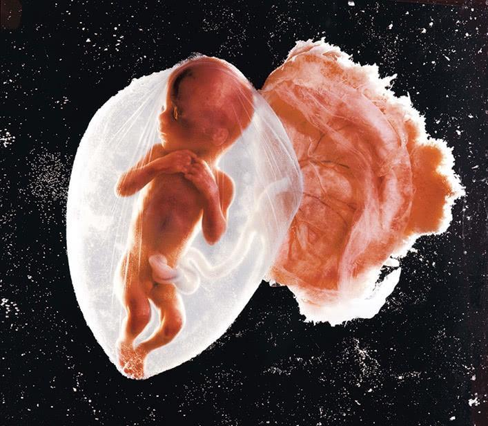 这是一张十八周的胎儿图,让人们感慨生命的伟大和神奇! 9.