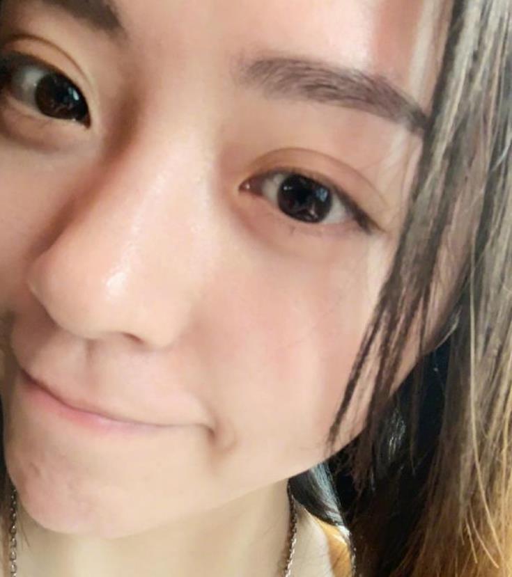 一双大眼睛双眼皮,笑起来显出两个可爱小酒窝