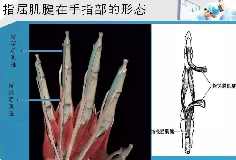 手部肌腱解剖及功能