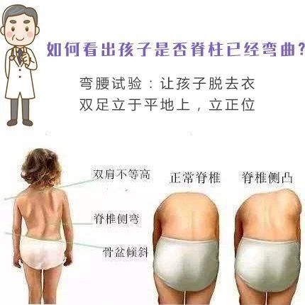 青少年脊柱弯曲发病多在10~18岁,但10岁以下,甚至3岁以下,也并不少见