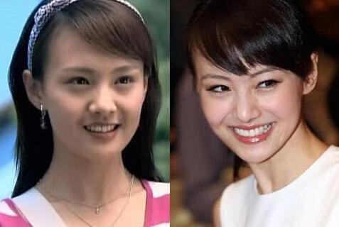 对比中韩整容女明星:为何韩国女星越整越美,中国女星越整越僵?