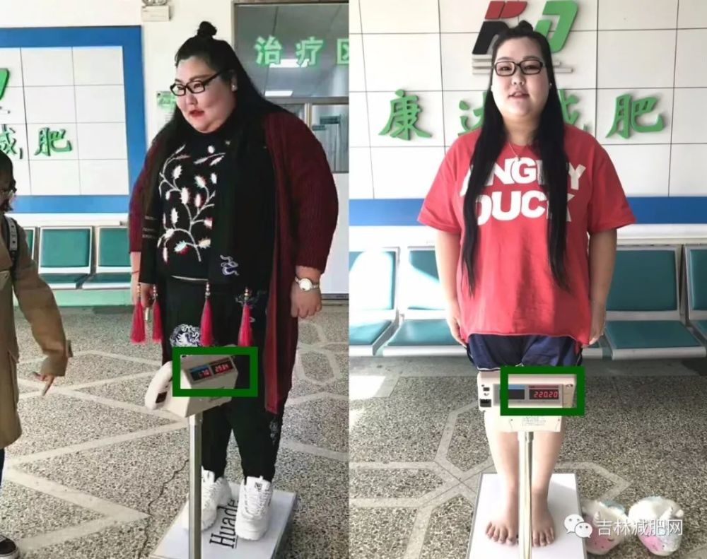 90后女演员长春减肥,三个月铲肉七十斤!