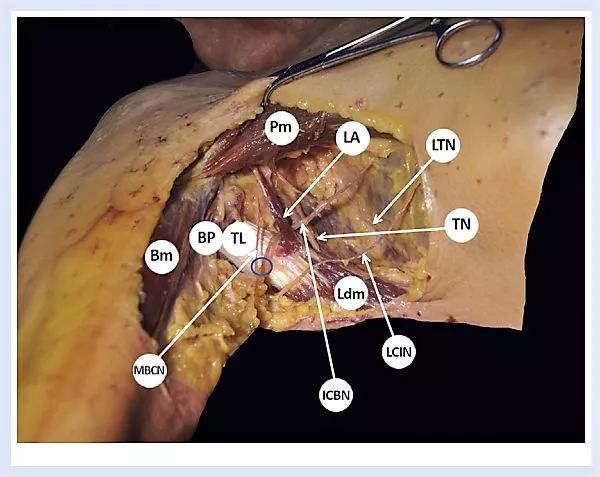 超声引导下前路腋神经和肋间臂神经阻滞:一项解剖学研究
