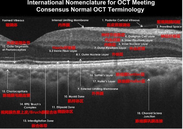 虽然 oct从发明至今才短短二十多年,但其在眼科临床中的应用已越来越