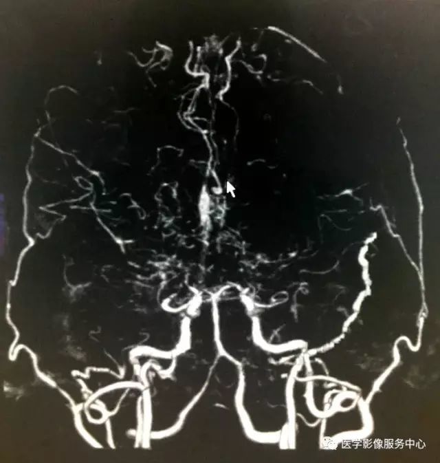 仅凭一层ct图像即可确诊这个疾病,你能做到吗?