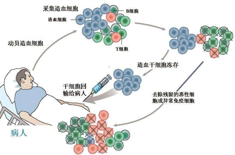 自体造血干细胞移植流程图