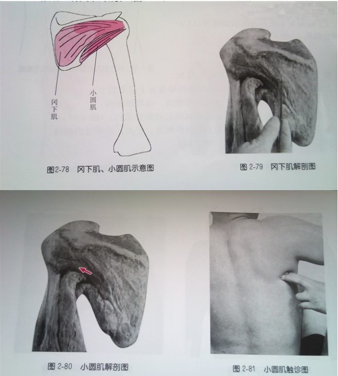 (图2-79 小圆肌:起点:肩胛骨外侧缘背面.止