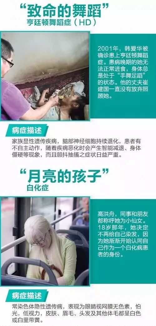 苯丙酮尿症,成骨不全症