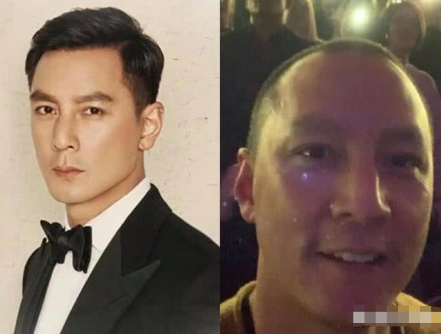 当明星发际线变高后,颜值真的神仙也救不了,网友:这是