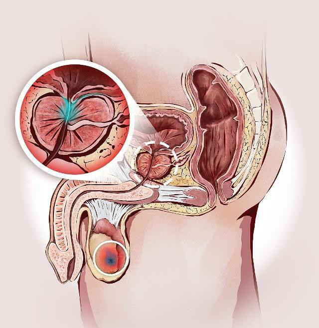 男人下腹部隐痛什么原因?其实这三个原因需引起重视!不妨看看嘛