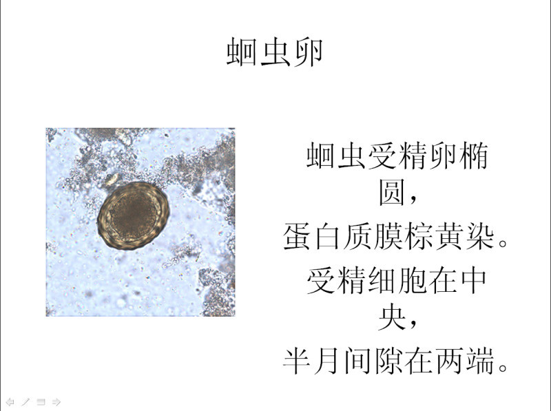 寄生虫学虫卵经典总结