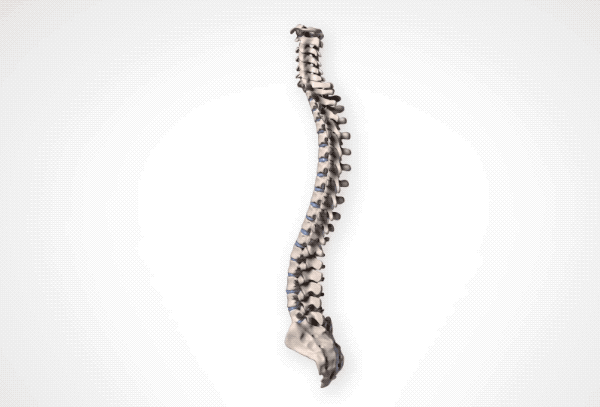 如果腰椎间盘会说话,腰疼的人必看!