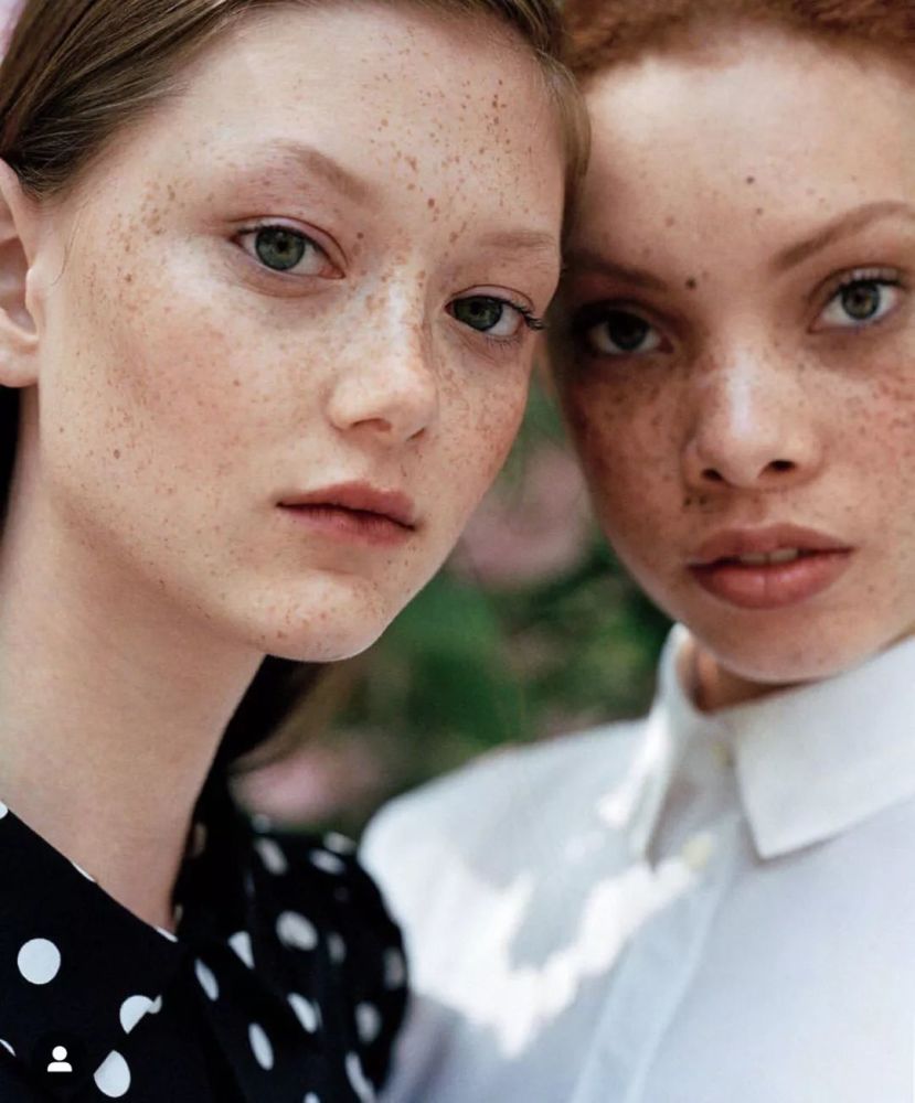 外国的模特可以有雀斑.