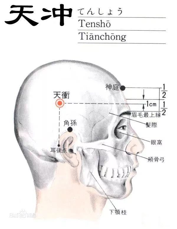 治头痛,齿龈肿痛——天冲穴