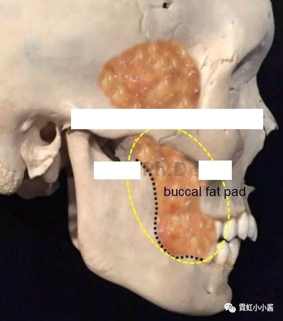 颊脂垫的位置在这儿,在表层脂肪和smas筋膜层下面,属于深层脂肪团.
