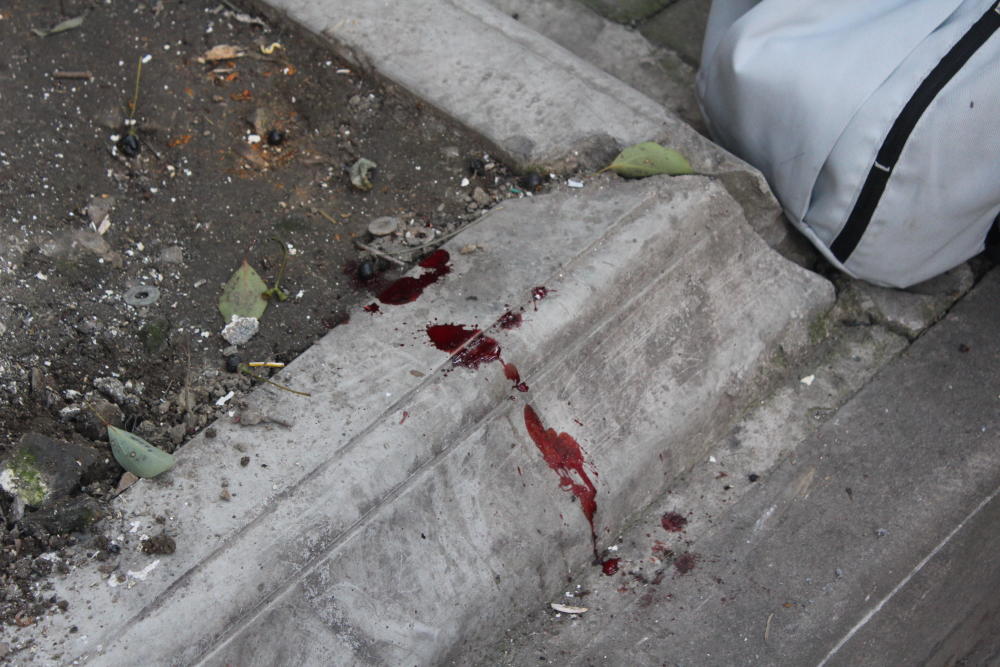 今晨苏州莫邪路:电动车保暖被惹祸 挂倒骑车大妈致鲜血直流!