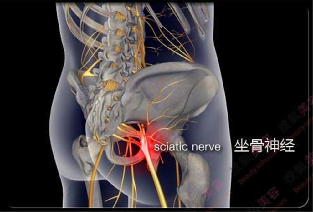 腰椎间盘突出压迫坐骨神经痛可以自愈吗?看完你就知道