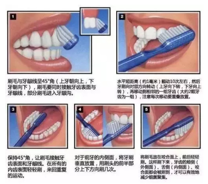 最有效的刷牙方式莫过于巴氏刷牙法了,大家可以看图学习一下.