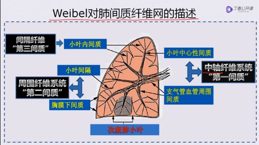 分分钟掌握:4 种肺间质病变的影像学改变