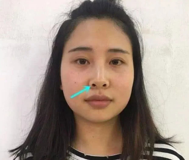 00后女生纠正3个"坏习惯",鼻子会越来越好看,小仙女就
