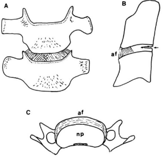 图示:颈椎间盘的前纤维环分 3 层.a = 过渡纤维, b = 浅纤维, c