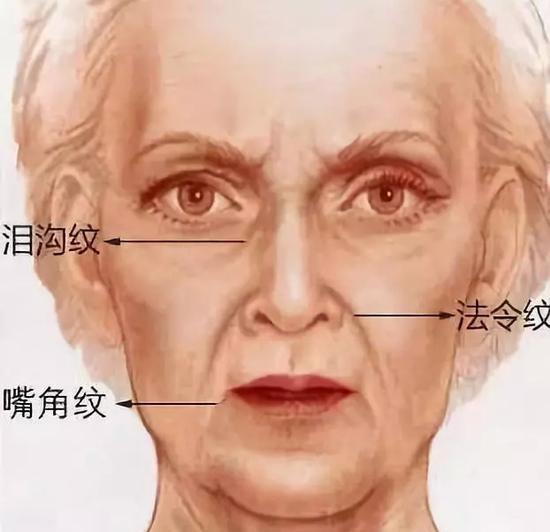 女人开始衰老,有4个表现,若占1个,可能提早进入了衰老