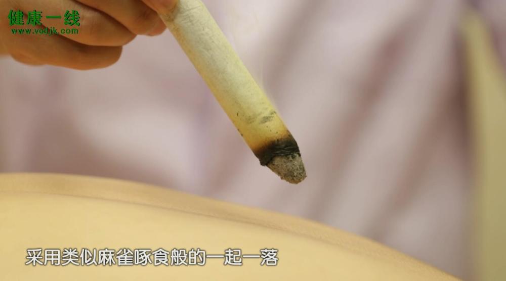 雀啄灸是艾条灸的一种,专治急症或胎位不正等疾病