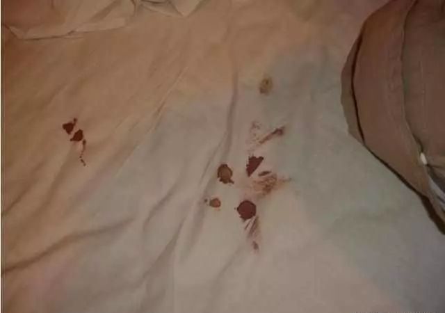 床单上的血迹干了洗不掉?教你一个土方法,再老的血迹都能除掉