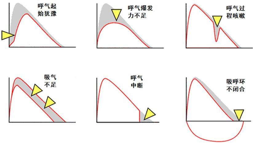 郑劲平:看看常用且重要的肺功能检查你做对了吗?
