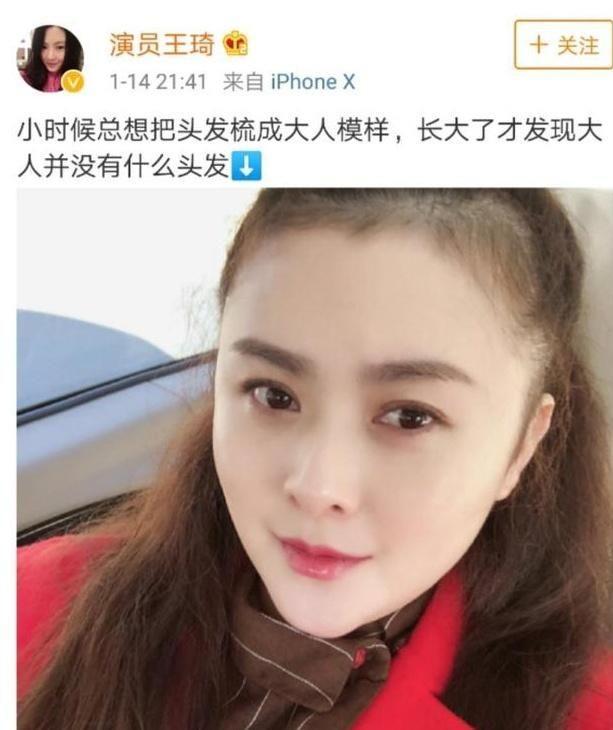 沈腾妻子王琦发自拍:产后脱发真是吓skr人!