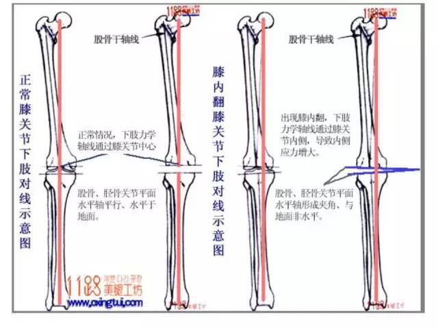 下肢生理力线特点