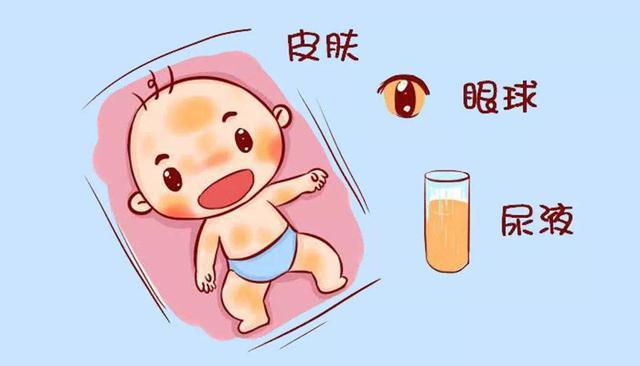 湖南新生儿严重黄疸,引发极重度高胆红素血症