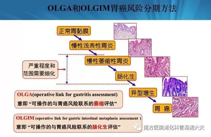 胃炎分期在胃癌二级预防中如何应用?