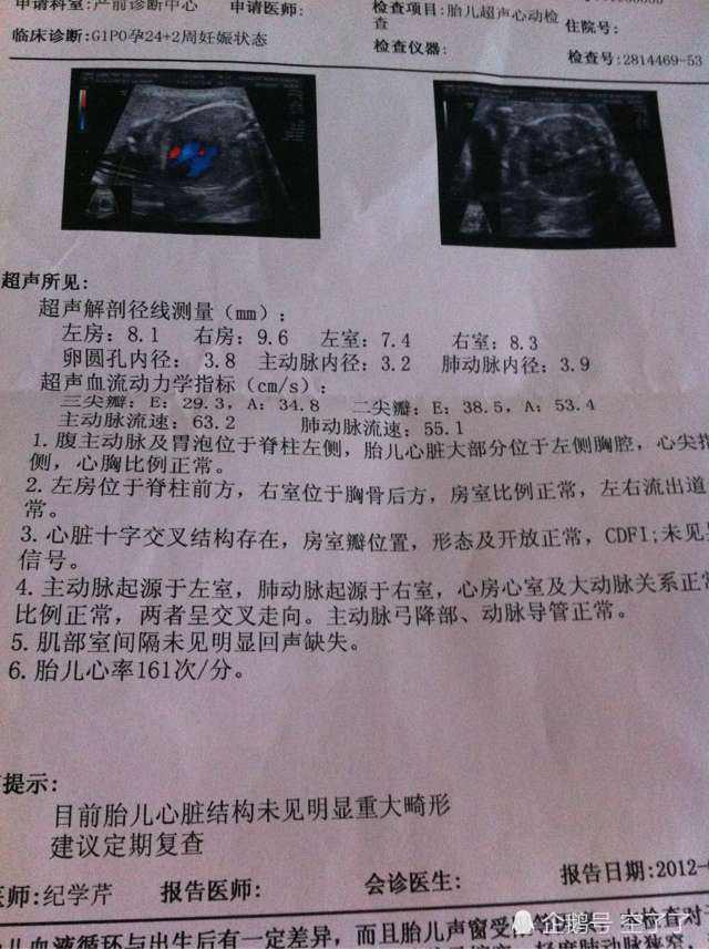 北京安贞医院早在20世纪90年代初便开展了胎儿心脏超声检查,许多医生