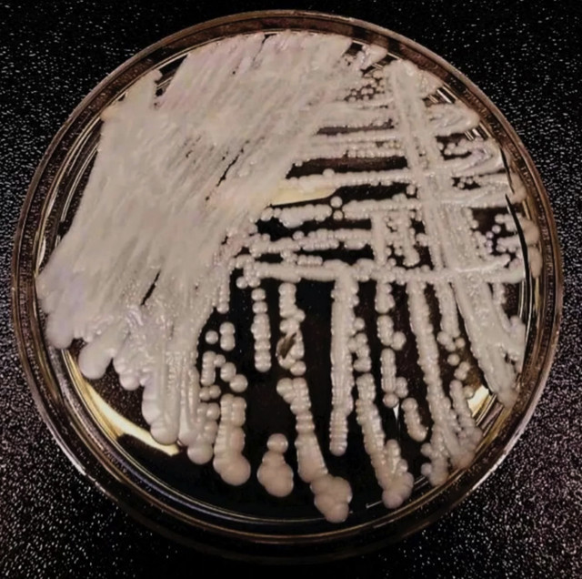 关于超级真菌感染您了解多少?