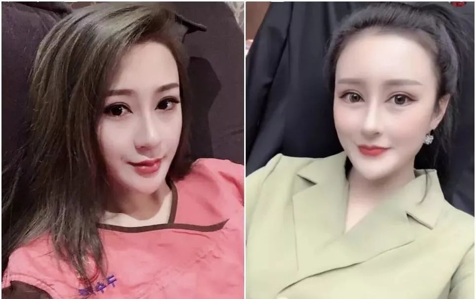 吴迪老婆文静承认整容!