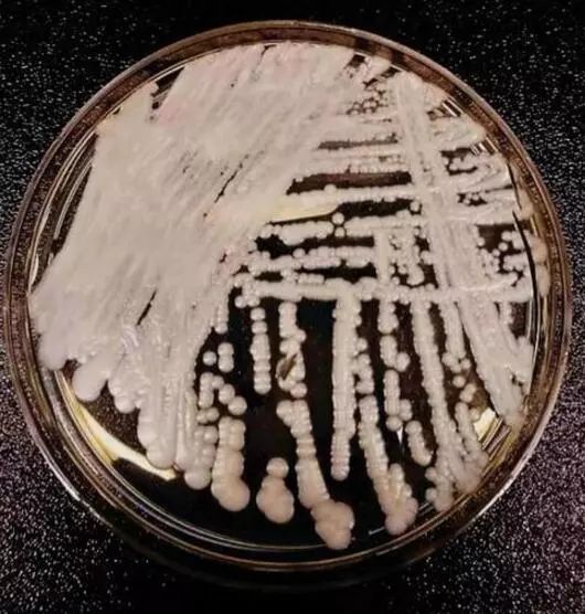 新型超级真菌来袭,中国确诊18例,怕没用,得这
