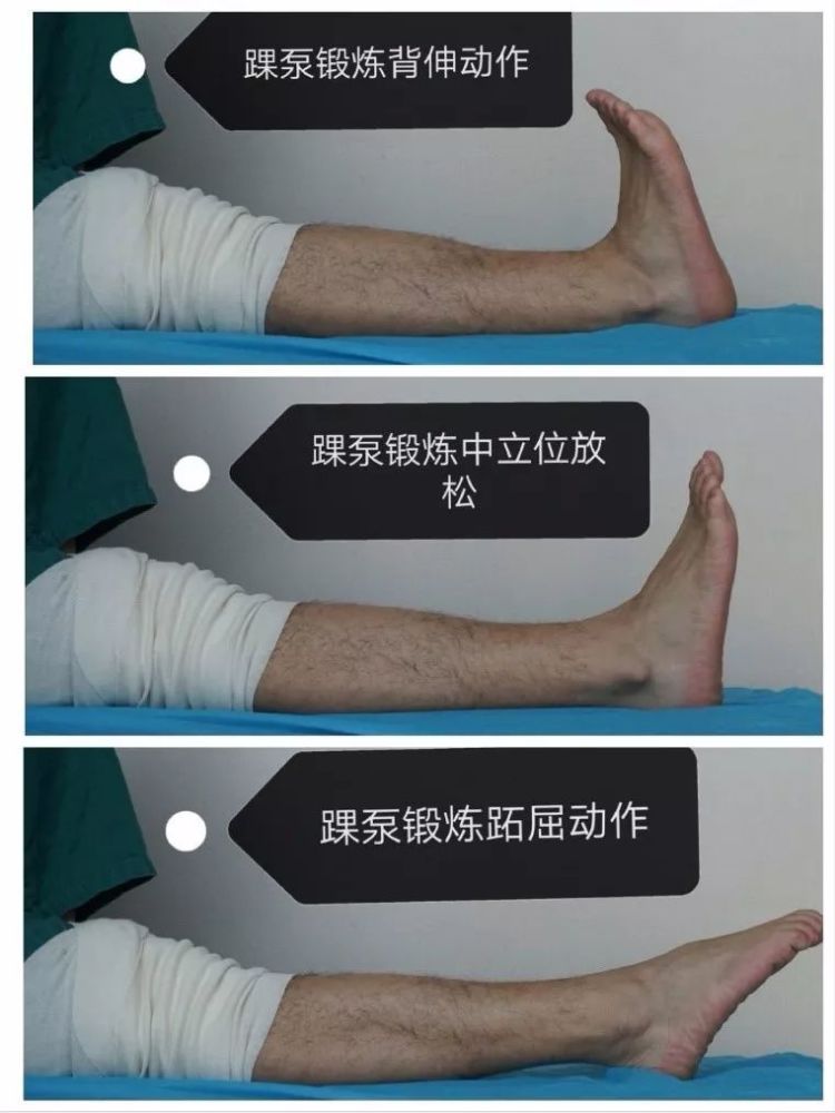 膝关节前交叉韧带重建术后的康复计划