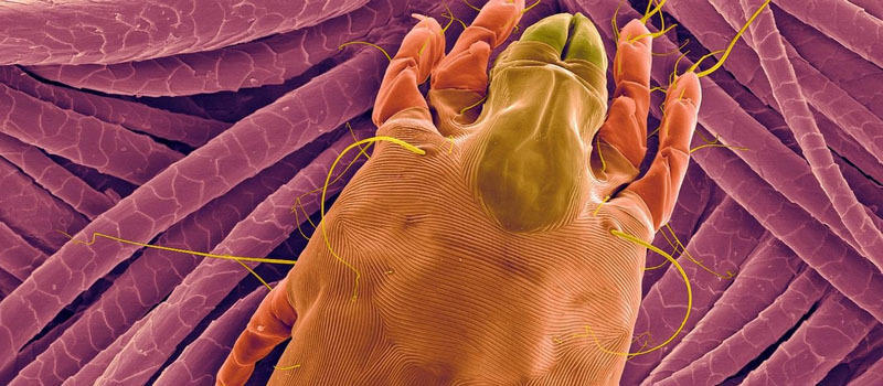 显微镜下的寄生虫真容鲜艳又诡异