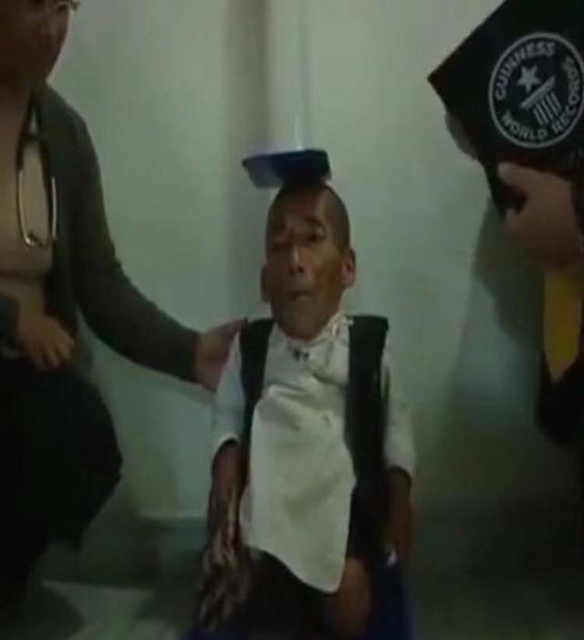 世界上最矮的男人,仅有3岁小孩的身高,成名后生活让人