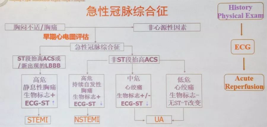 如何快速识别高危胸痛?多图表解析心电图诊断思路