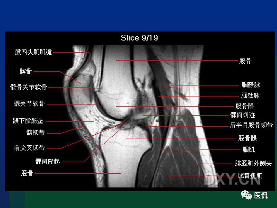 膝关节mri解剖及损伤#医学影像经典ppt