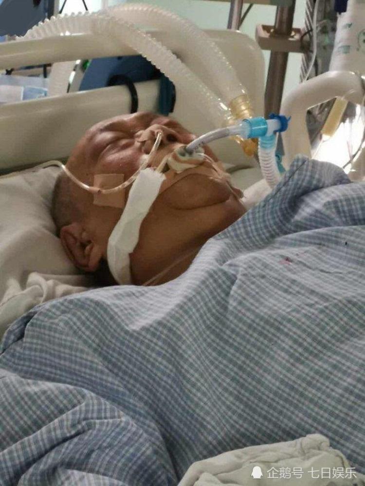 68岁金像奖最佳男配被曝病危已转icu满身插管抢救治疗