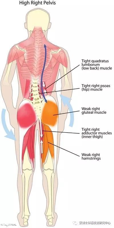 导致骨盆倾斜的元凶之:腰方肌的松解与拉伸方法