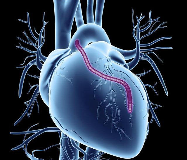 腾讯欧宝直播-share555大夫明白话这些心脏手术：心脏支架！搭桥！移植！起搏！射频！(3)